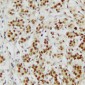 Anti-CTBP2 Antibody